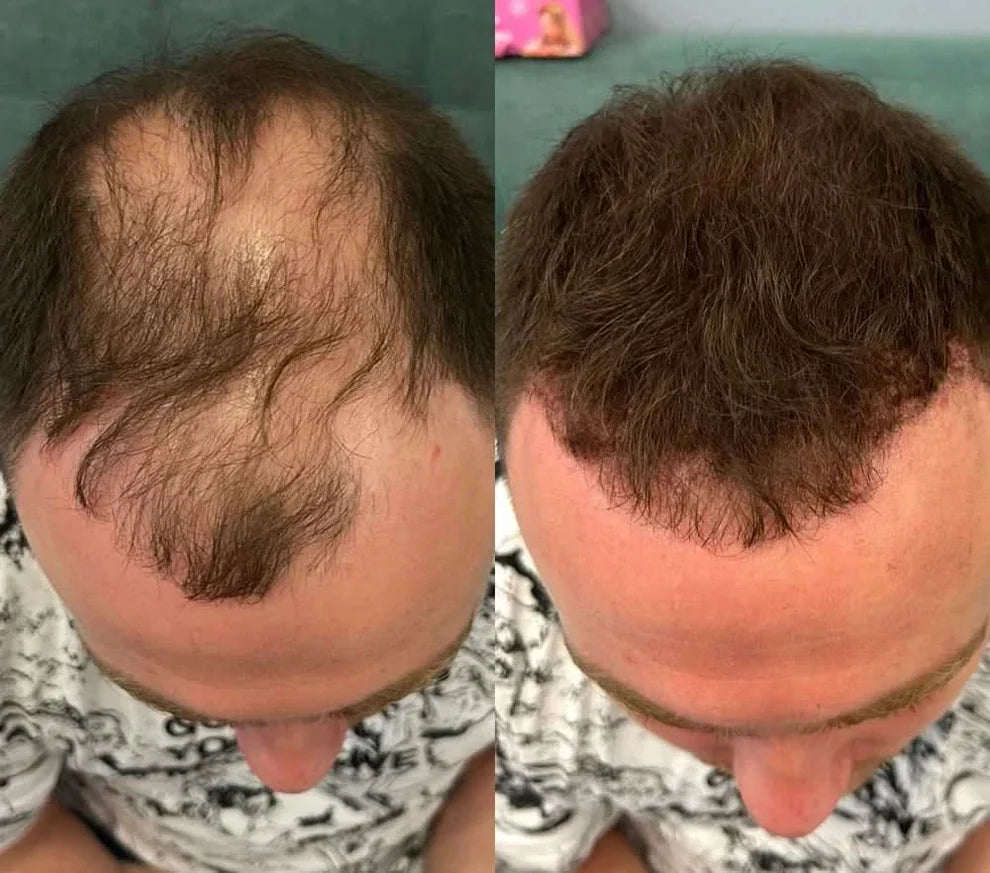 Rivon-Hair line Cover Powder