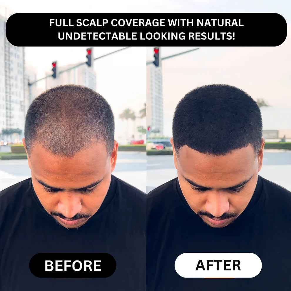 Rivon-Hair line Cover Powder