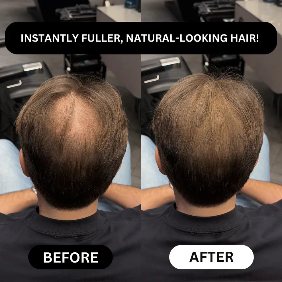 Rivon-Hair line Cover Powder