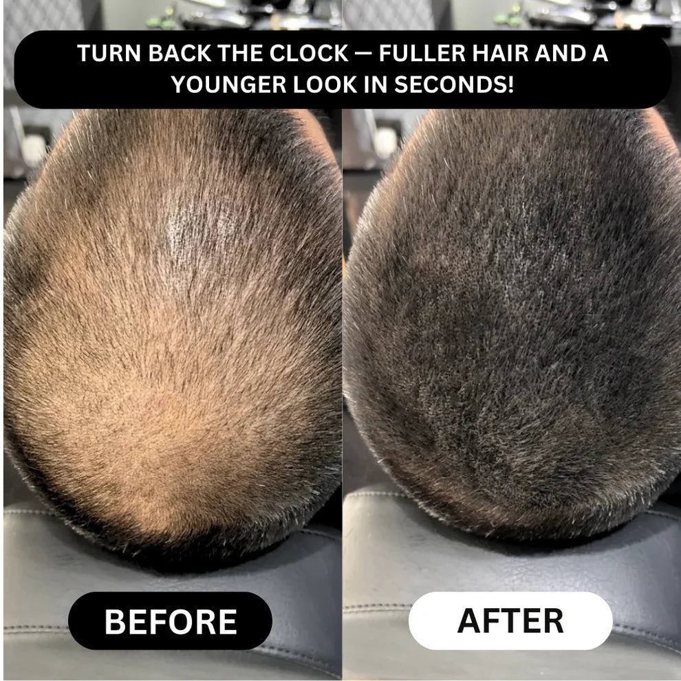 Rivon-Hair line Cover Powder