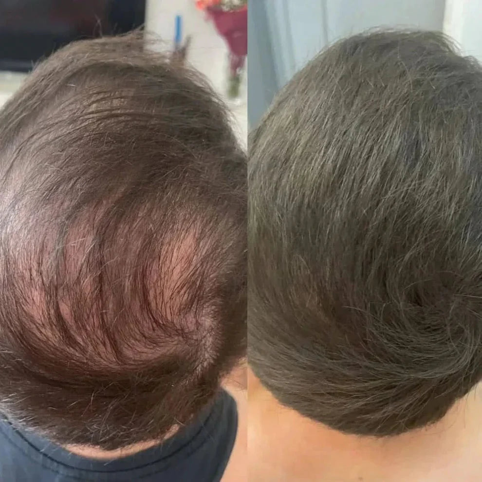 Rivon-Hair line Cover Powder
